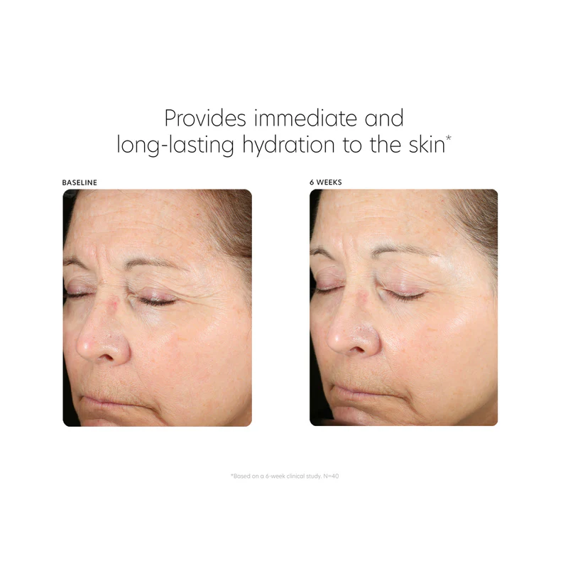 Hyaluronic Acid Boosting Serum - Image 6