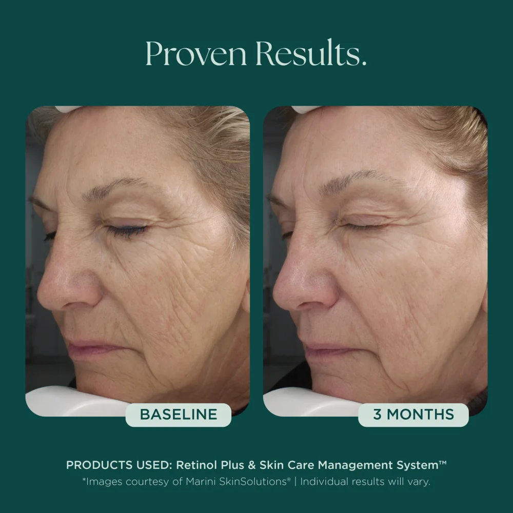 Retinol Plus - Image 2