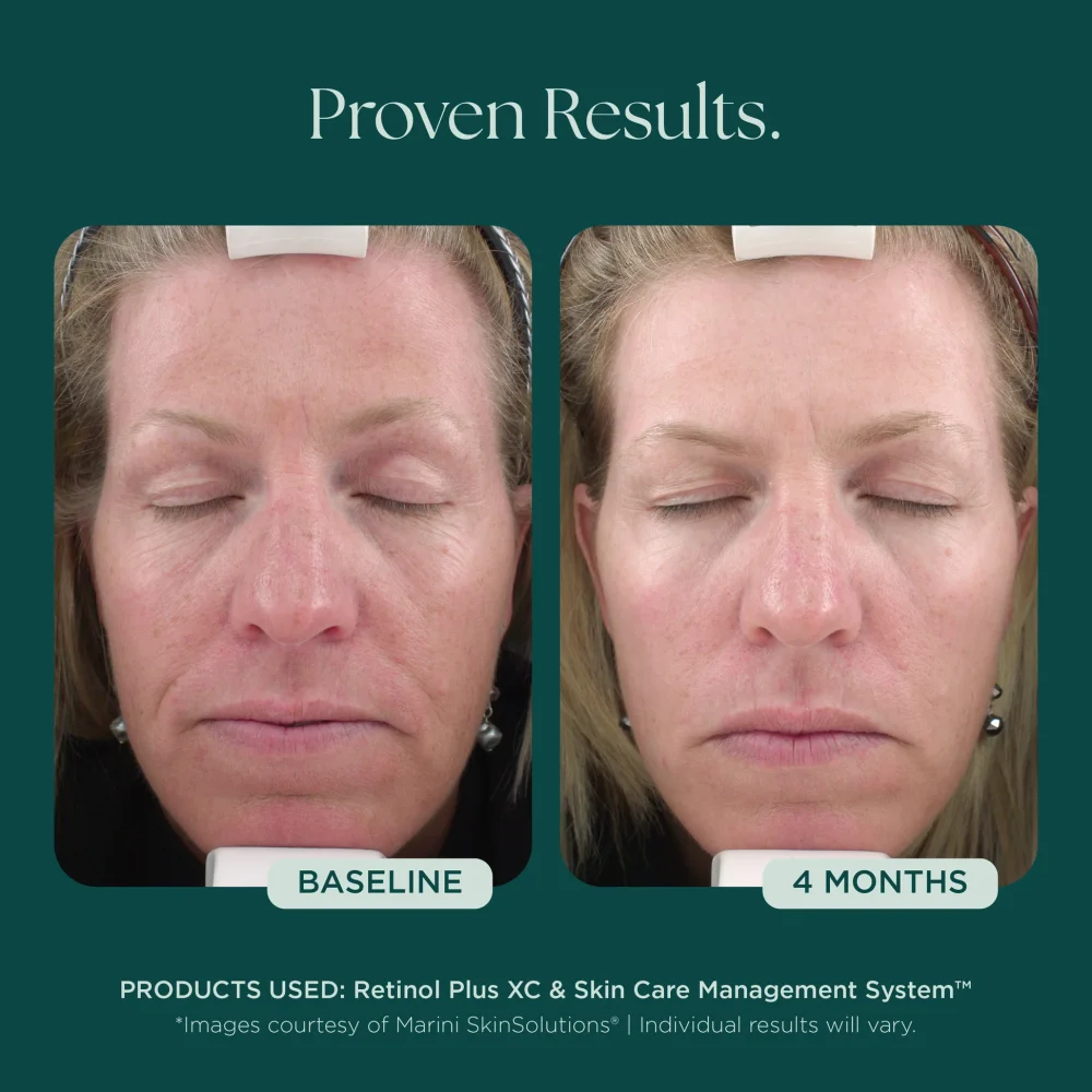 Retinol Plus - Image 3