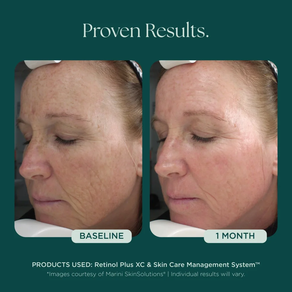 Retinol Plus - Image 4