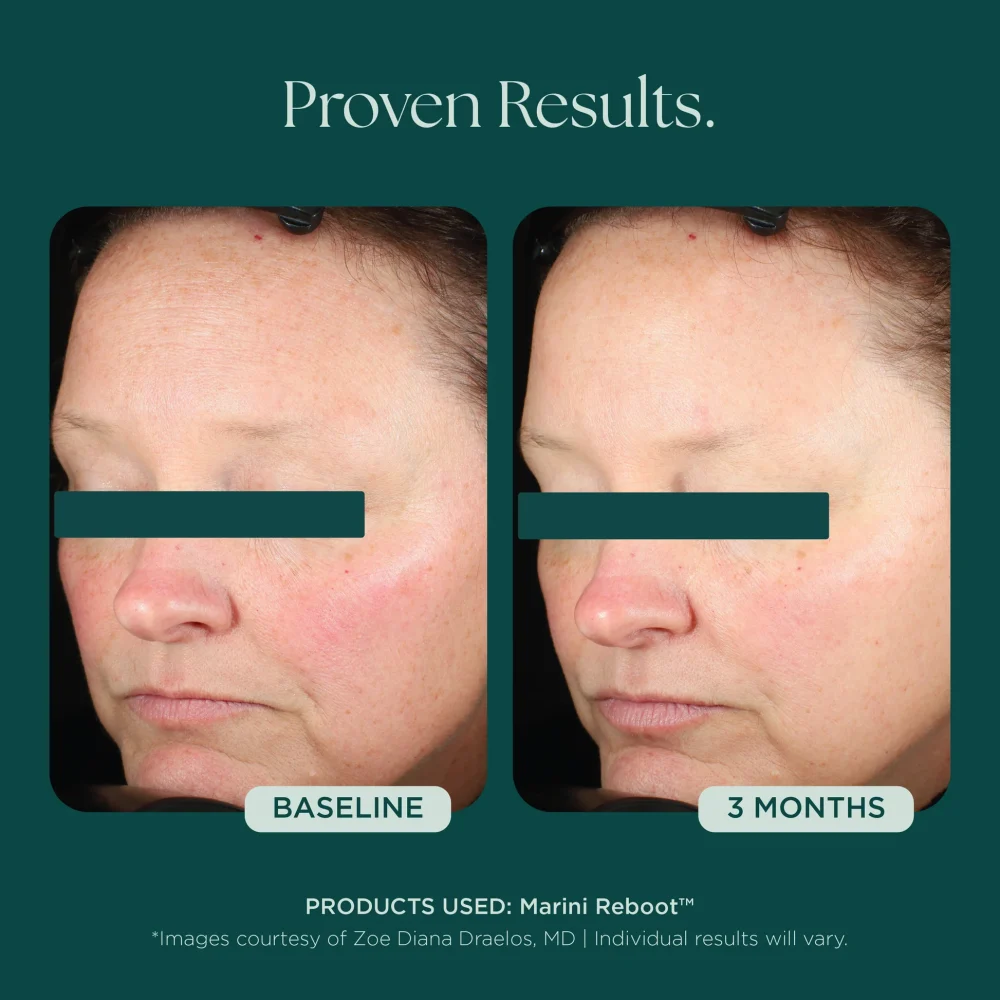Marini Reboot® PDRN Face Serum - Image 3