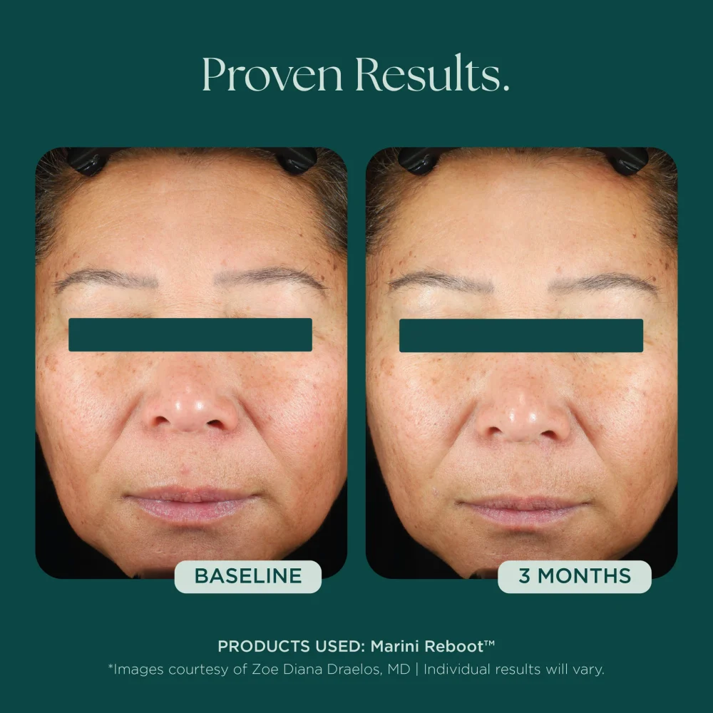 Marini Reboot® PDRN Face Serum - Image 4