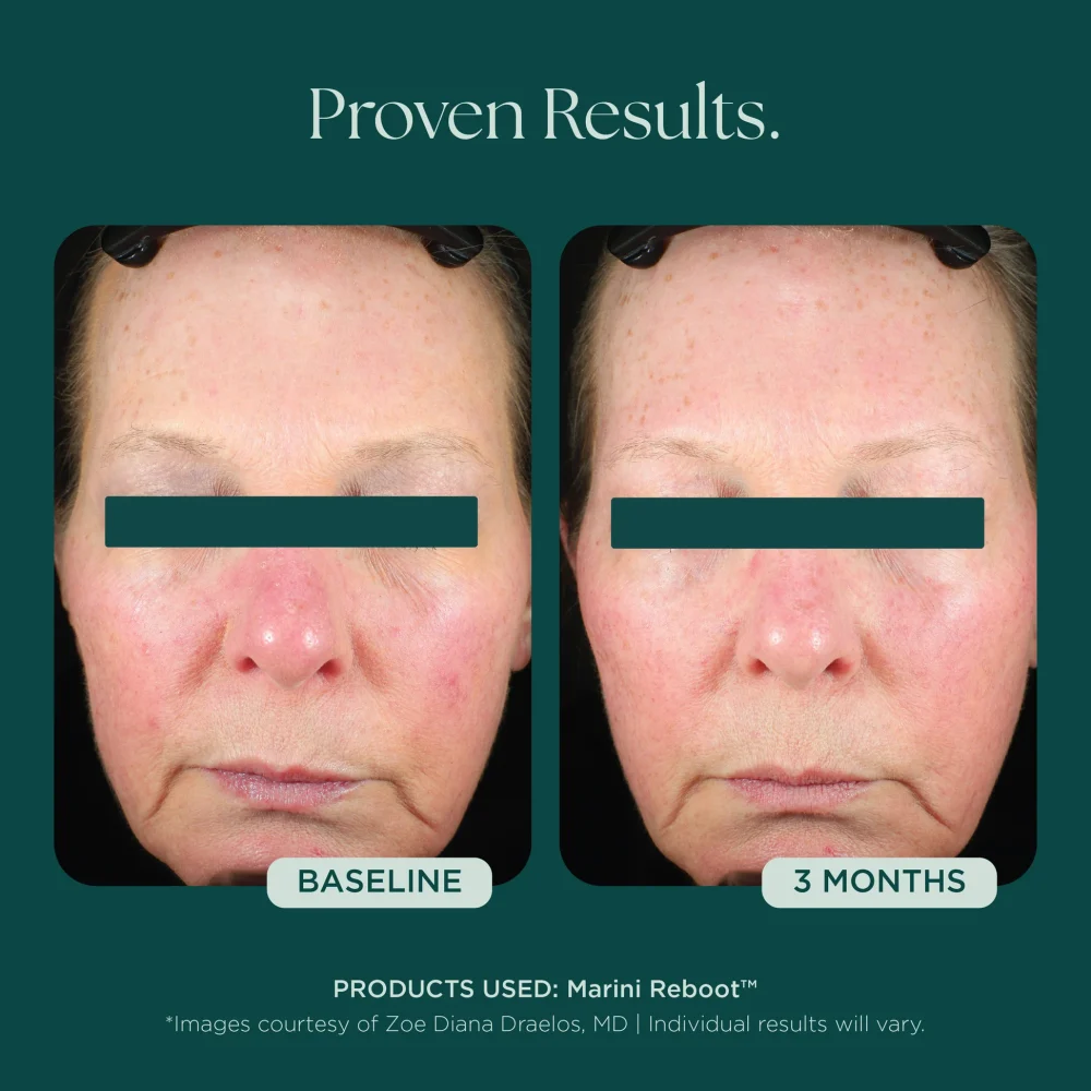 Marini Reboot® PDRN Face Serum - Image 5