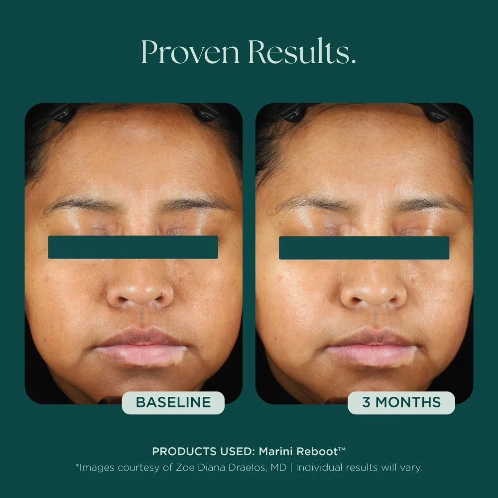 Marini Reboot® PDRN Face Serum - Image 6