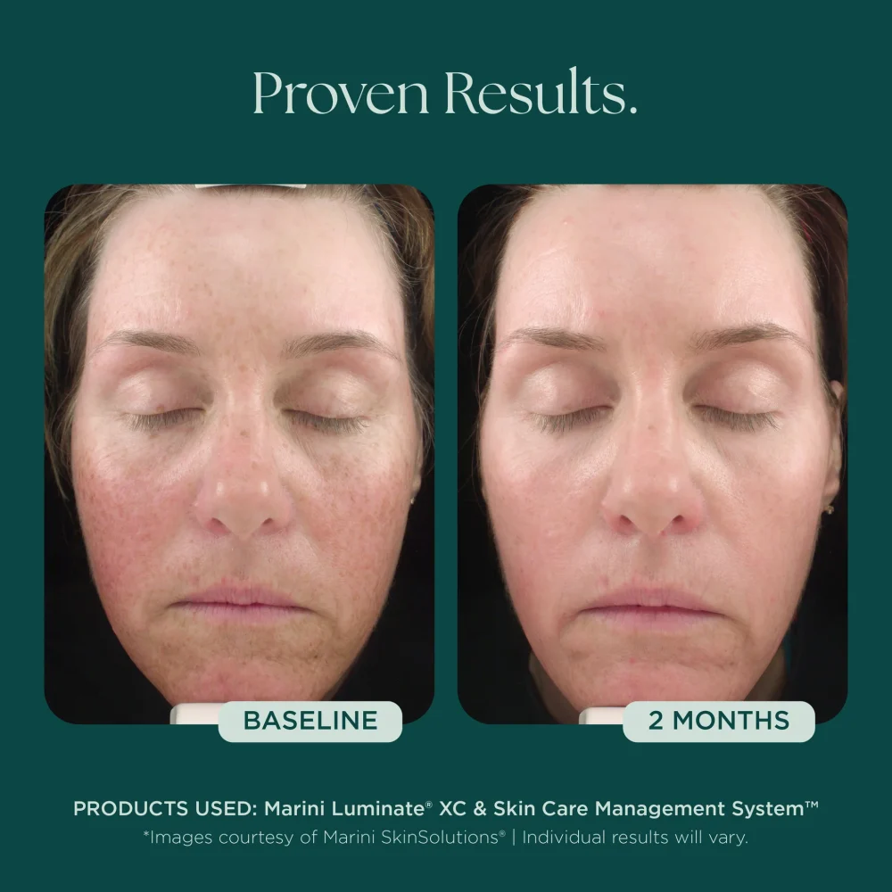 Marini Luminate® - Image 3