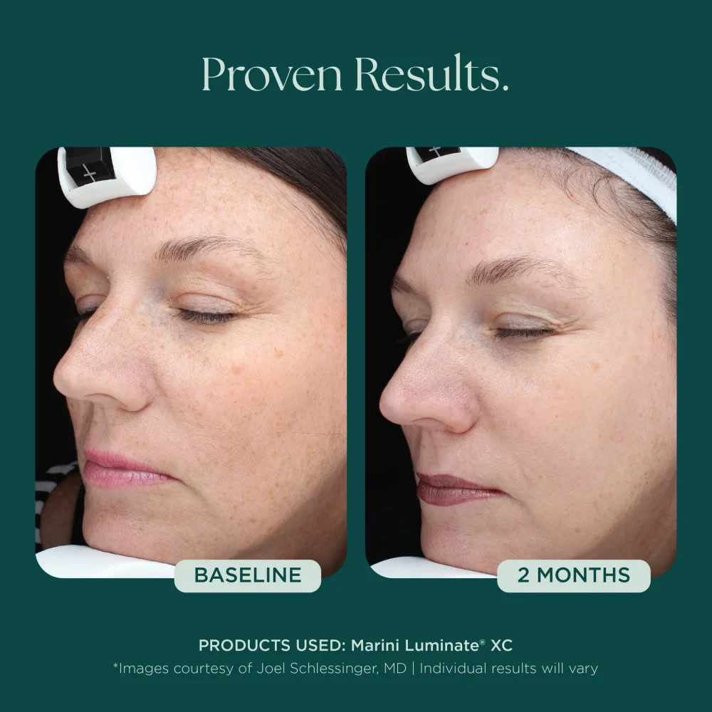 Marini Luminate® - Image 4