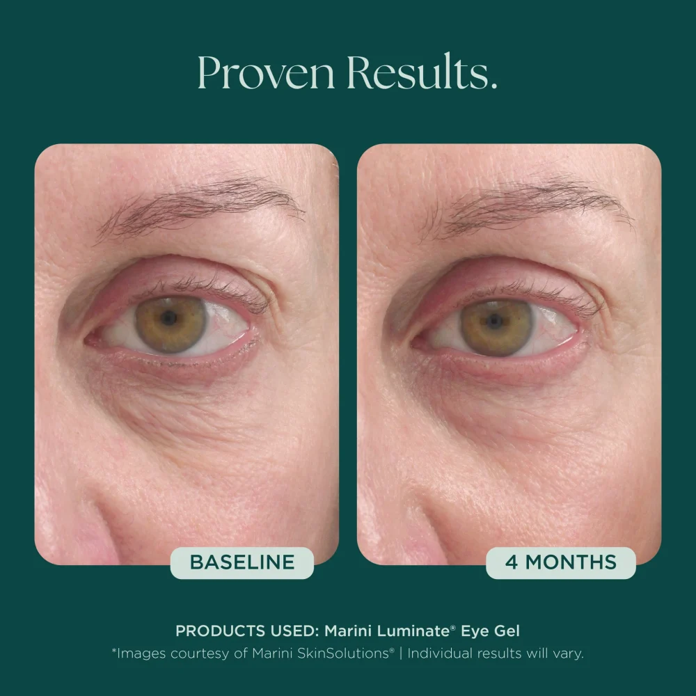 Marini Luminate® Eye Gel - Image 3