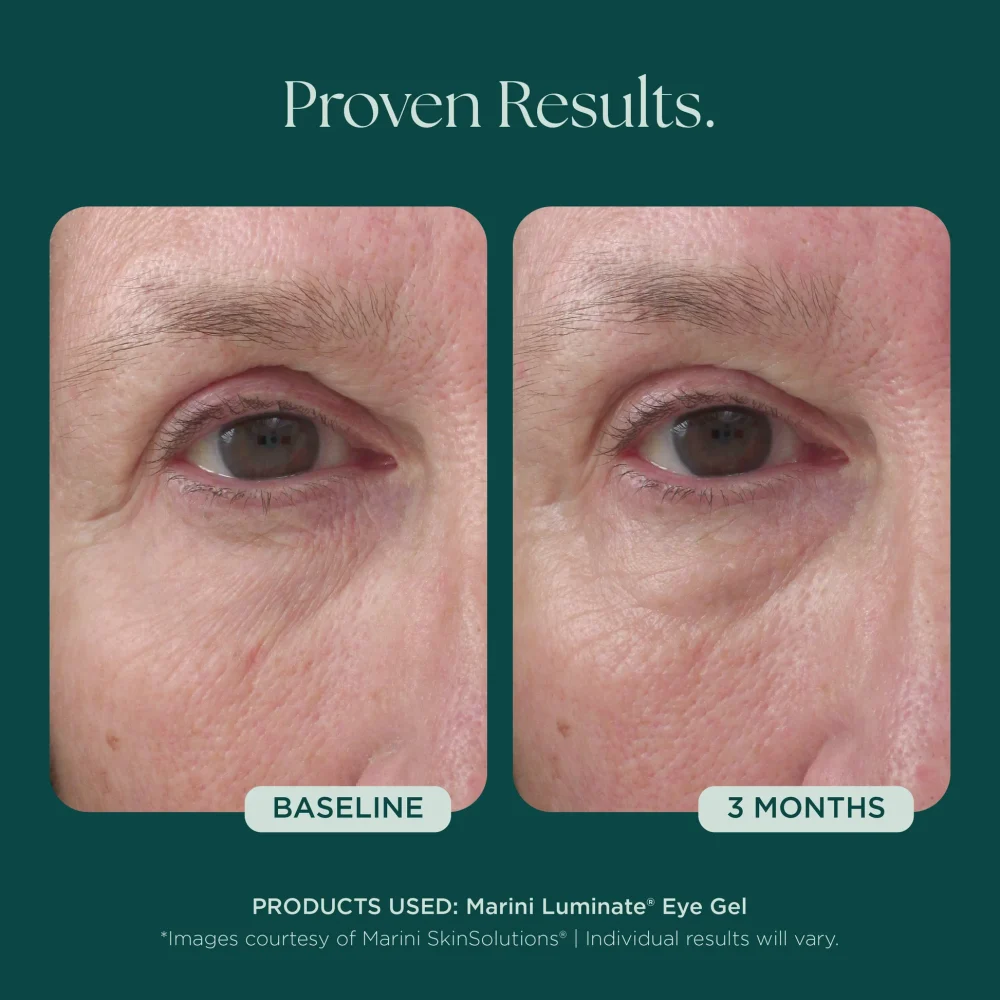 Marini Luminate® Eye Gel - Image 4