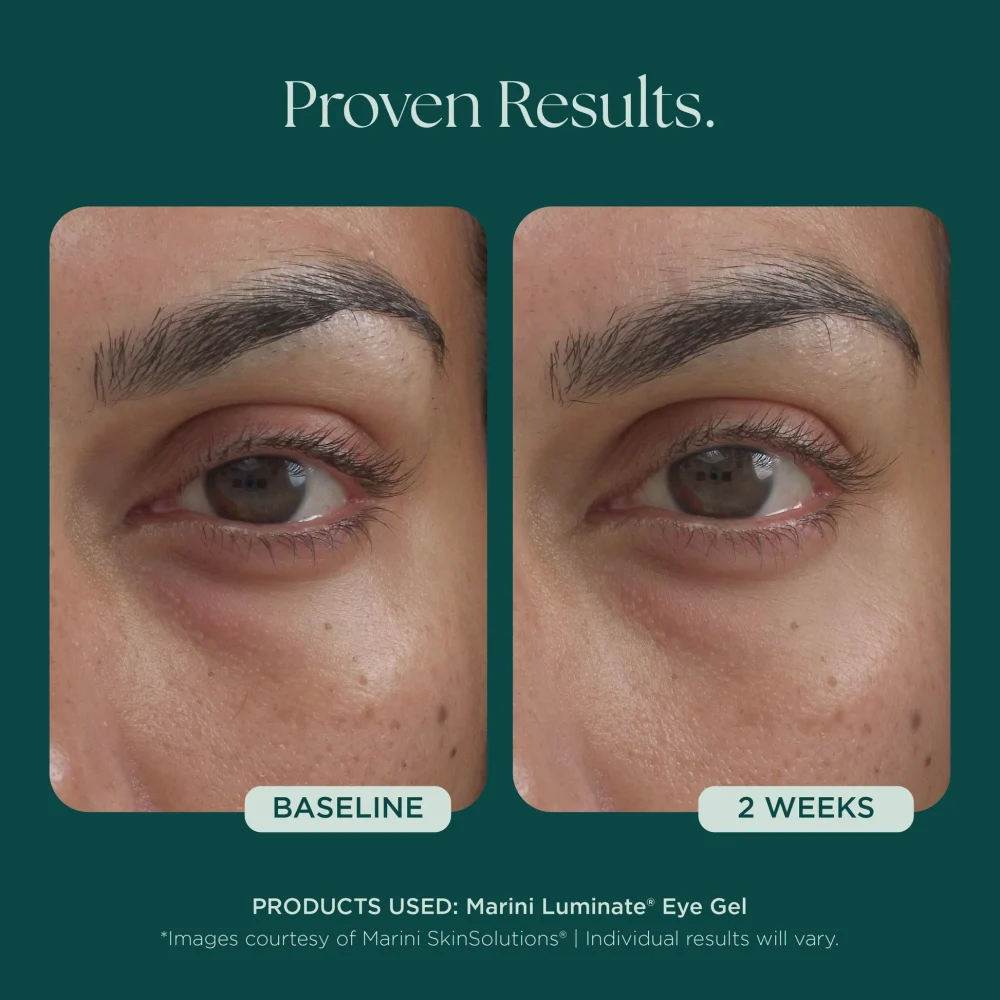 Marini Luminate® Eye Gel - Image 5
